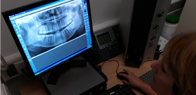 Dental X-Ray on computer