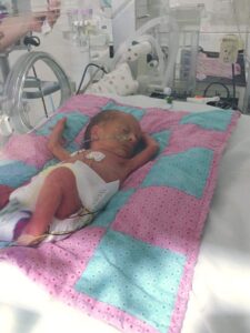 Newborn baby, Martha McNeill, in an incubator